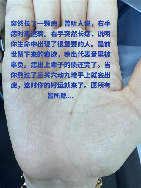 右手背突然长痣|右手突然长痣代表什么 老人说右手突然长痣代表什么 